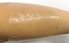 Waterproof Sterile Self-Adhesive Collagen Would Dressing