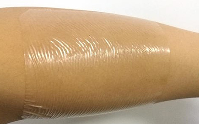 Waterproof Sterile Self-Adhesive Collagen Would Dressing