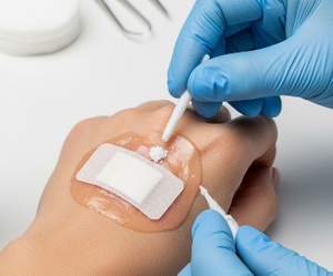 collagen wound dressing powder.png